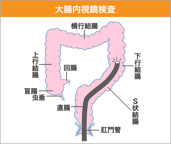 大腸内視鏡検査